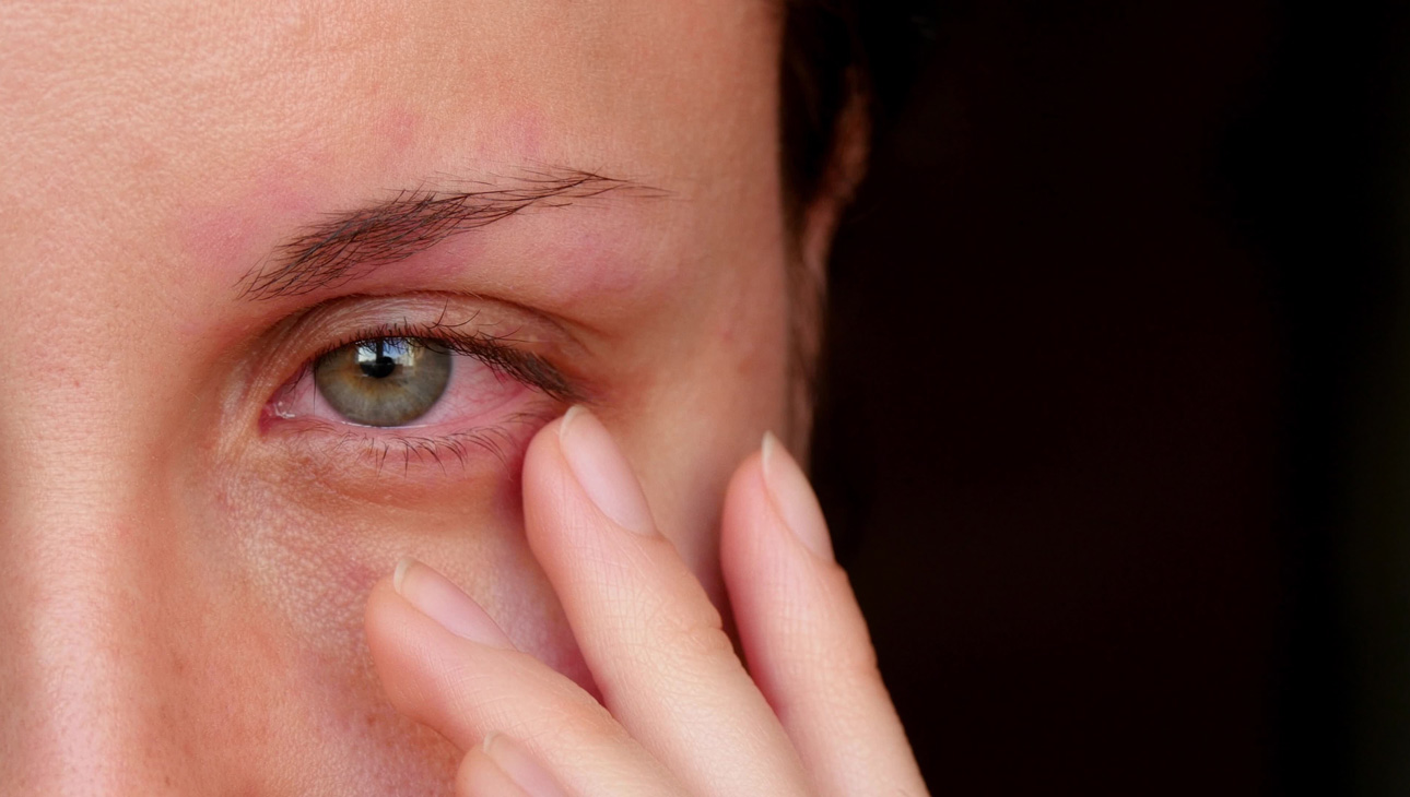 Koronavírus tünete: így jelzi a szem, hogy baj van - EgészségKalauz